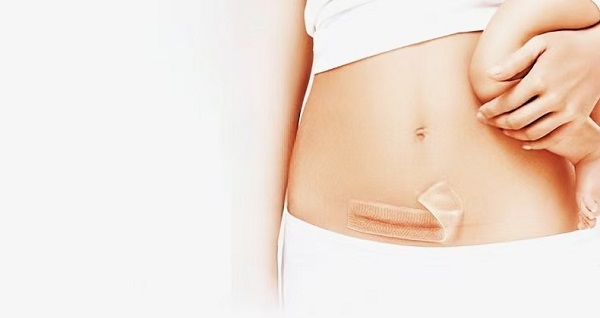 厚いシリコーンゲル傷跡シートがなぜこれほど人気が​​あるのですか?